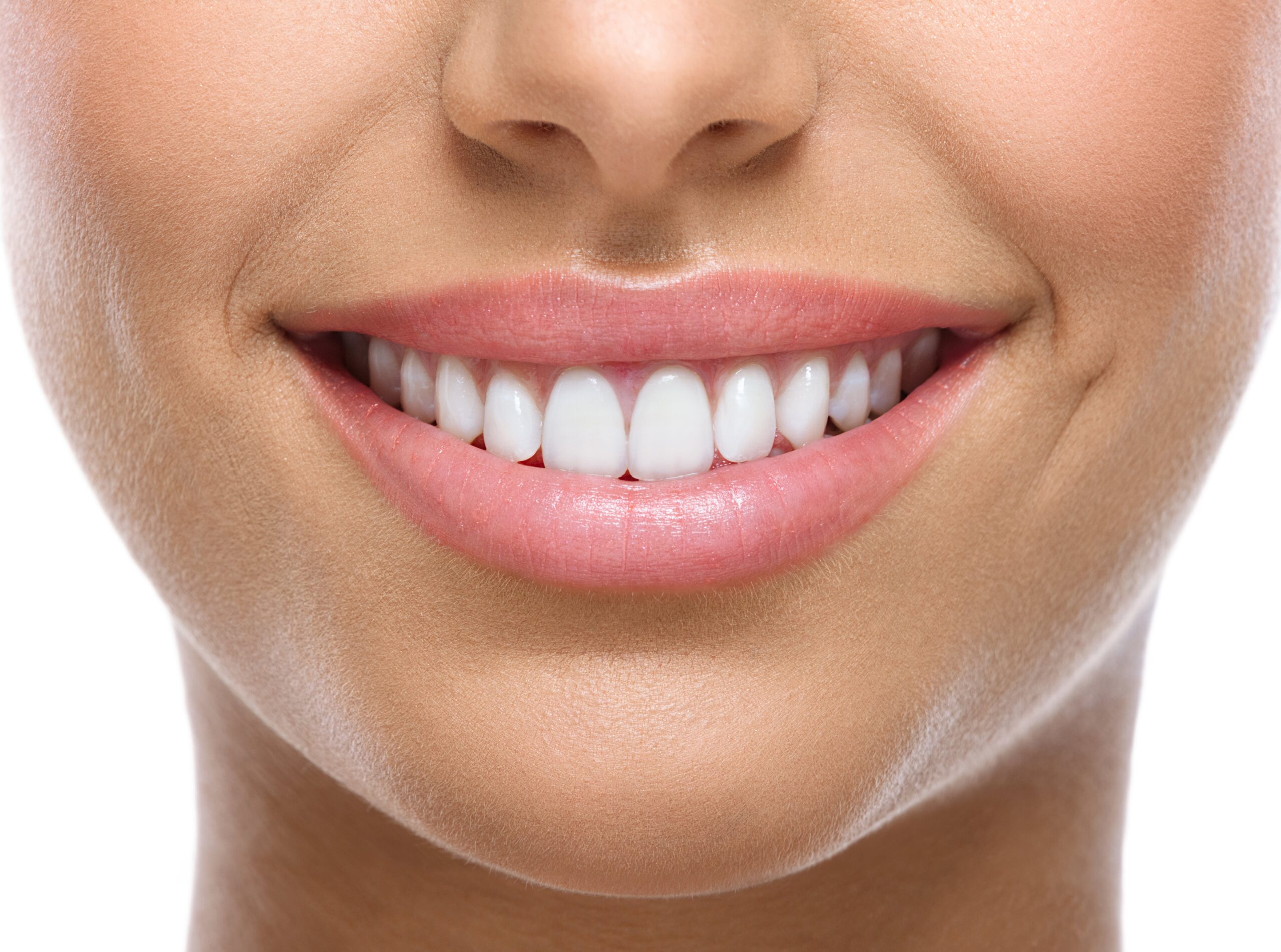 Belles dents blanches d'une jeune femme après un éclaircissement dentaire.